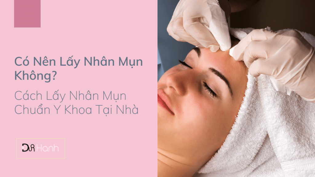 có nên nặn mụn không - dr hanh