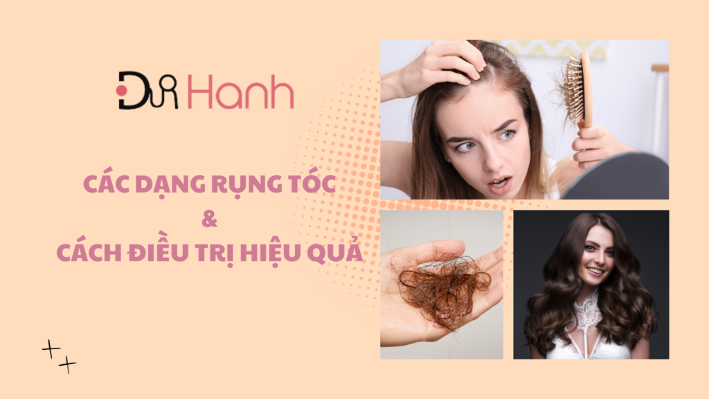 Dr Hạnh, Lương Mỹ Hạnh, BS Hạnh, Tóc, Rụng Tóc